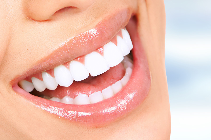 Porcelain Dental Veneers in Statesboro