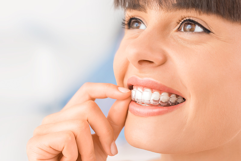 Invisalign® in Statesboro in Statesboro